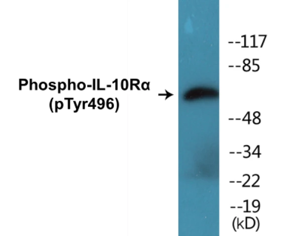 IL-10R alpha (phospho Tyr496) Cell Based ELISA Kit (A102767-296)