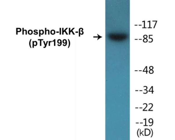 IKK beta (phospho Tyr199) Cell Based ELISA Kit (A102577-296)