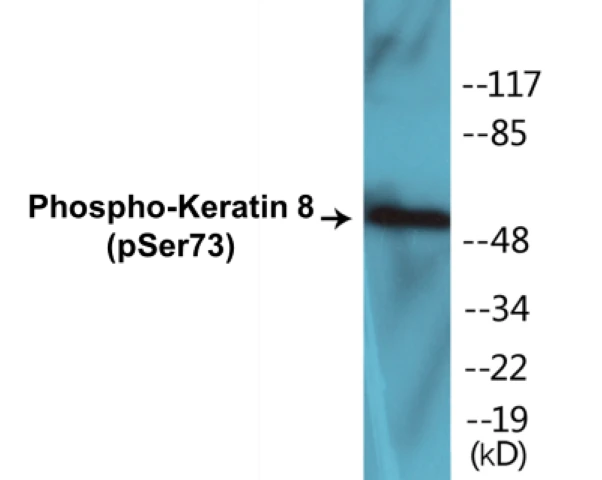 Keratin 8 (phospho Ser73) Cell Based ELISA Kit (A102691-296)