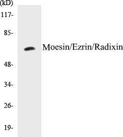 Moesin Cell Based ELISA Kit (A103010-96)