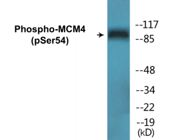 MCM4 (phospho Ser54) Cell Based ELISA Kit (A102671-296)