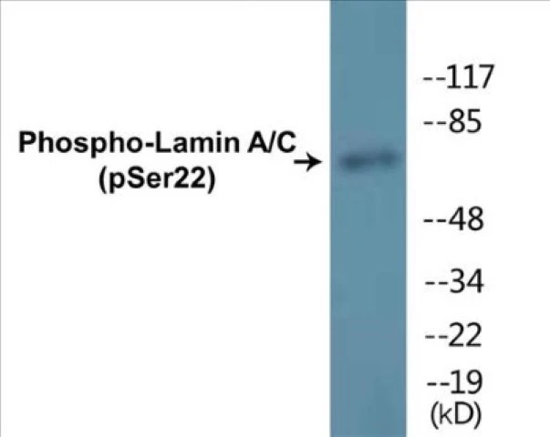 Lamin A + C (phospho Ser22) Cell Based ELISA Kit (A102514-296)