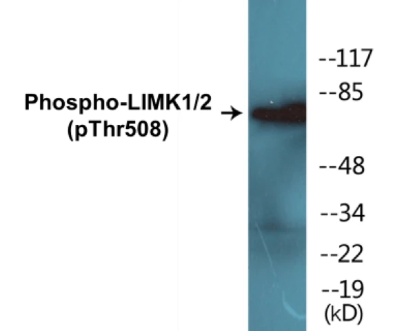 LIMK1 + 2 (phospho Thr508) Cell Based ELISA Kit (A102553-296)