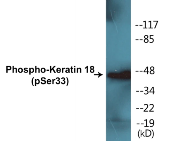 Keratin 18 (phospho Ser33) Cell Based ELISA Kit (A102533-296)