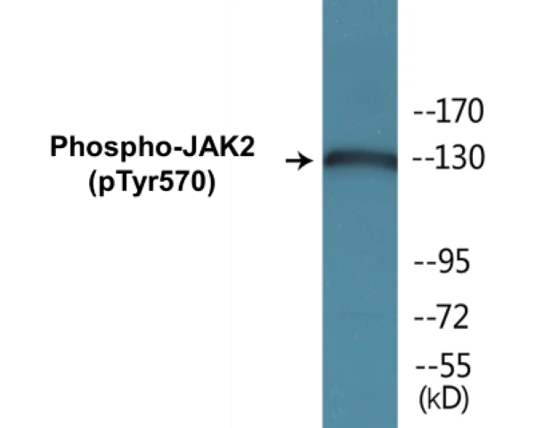 JAK2 (phospho Tyr570) Cell Based ELISA Kit (A102295-296)