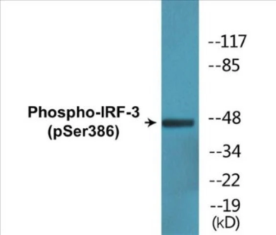 IRF-3 (phospho Ser386) Cell Based ELISA Kit (A102722-296)