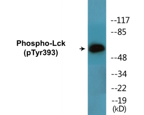 Lck (phospho Tyr393) Cell Based ELISA Kit (A102441-296)