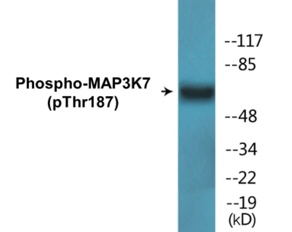 MAP3K7 (phospho Thr187) Cell Based ELISA Kit (A102086-296)