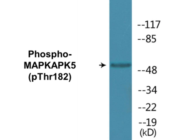 MAPKAPK5 (phospho Thr182) Cell Based ELISA Kit (A102693-296)