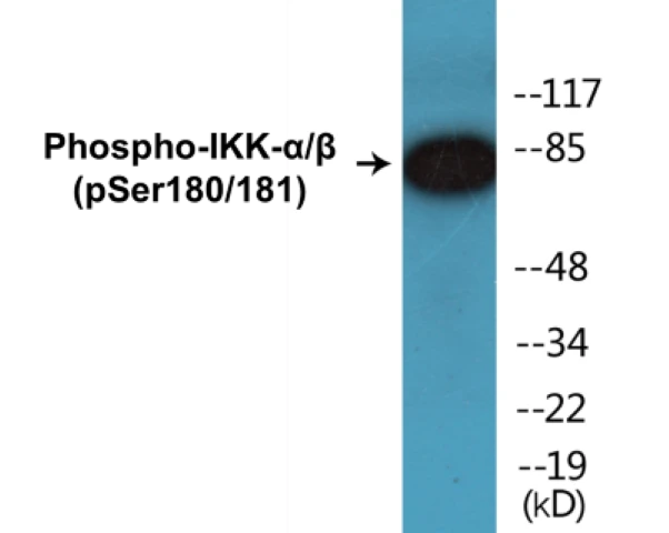 IKK alpha + beta (phospho Ser180 + Ser181) Cell Based ELISA Kit (A102458-296)