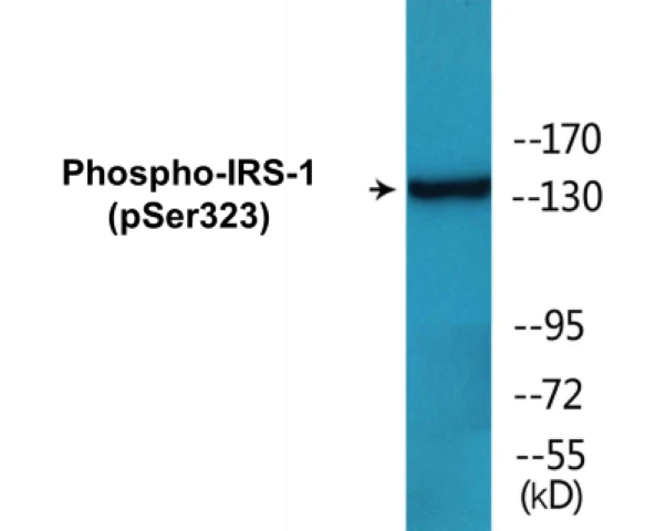 IRS-1 (phospho Ser323) Cell Based ELISA Kit (A102153-296)