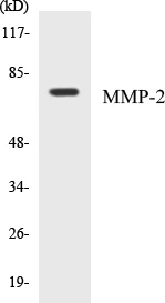 MMP-2 Cell Based ELISA Kit (A103103-96)