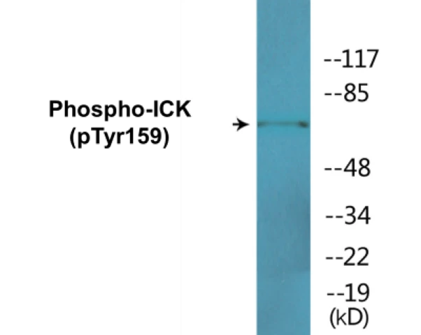 ICK (phospho Tyr159) Cell Based ELISA Kit (A102449-296)