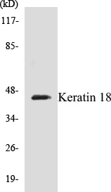 Keratin 18 Cell Based ELISA Kit (A102882-96)