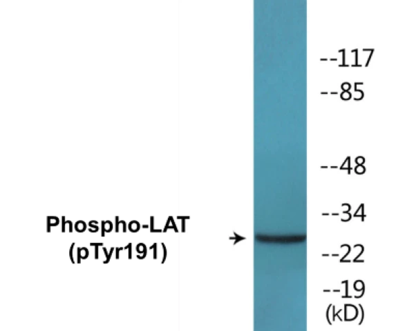 LAT (phospho Tyr191) Cell Based ELISA Kit (A102421-296)