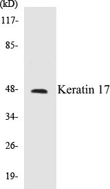 Keratin 17 Cell Based ELISA Kit (A102893-96)