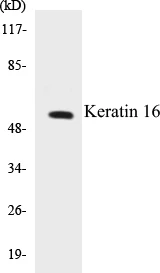 Keratin 16 Cell Based ELISA Kit (A102892-96)