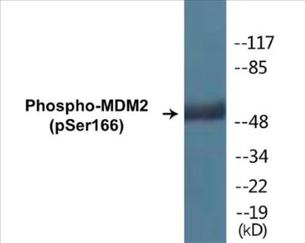 MDM2 (phospho Ser166) Cell Based ELISA Kit (A102639-296)