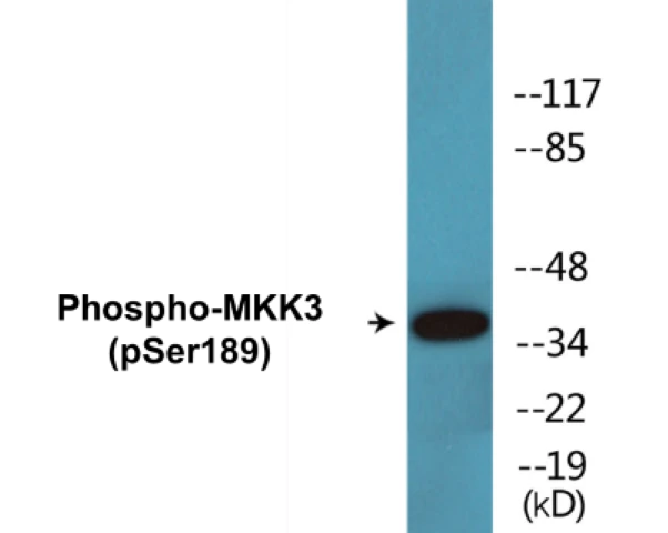 MKK3 (phospho Ser189) Cell Based ELISA Kit (A102281-296)