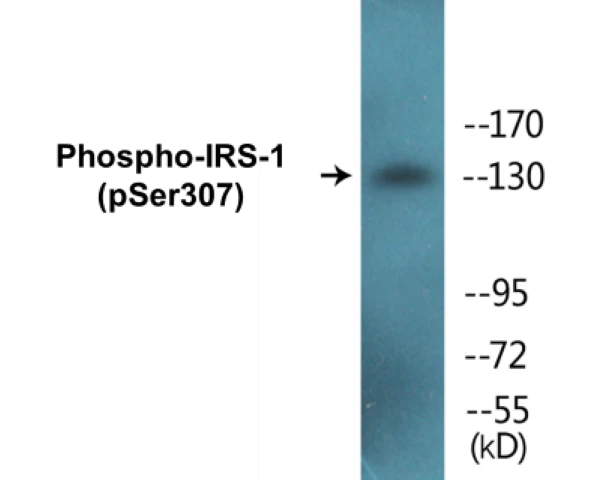 IRS-1 (phospho Ser307) Cell Based ELISA Kit (A102141-296)