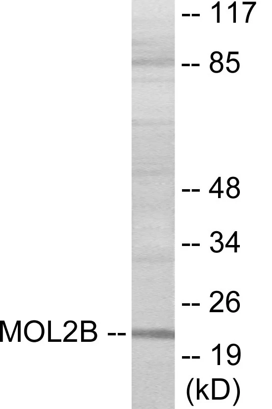 MOBKL2B Cell Based ELISA Kit (A103405-96)