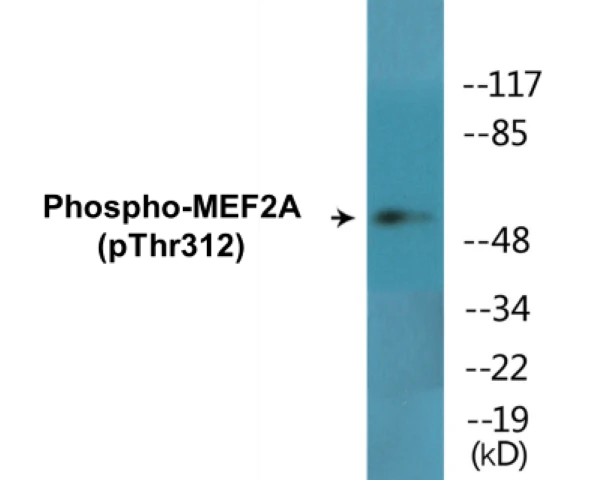 MEF2A (phospho Thr312) Cell Based ELISA Kit (A102208-296)