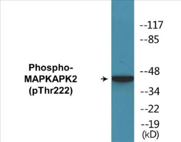 MAPKAPK2 (phospho Thr222) Cell Based ELISA Kit (A102579-296)