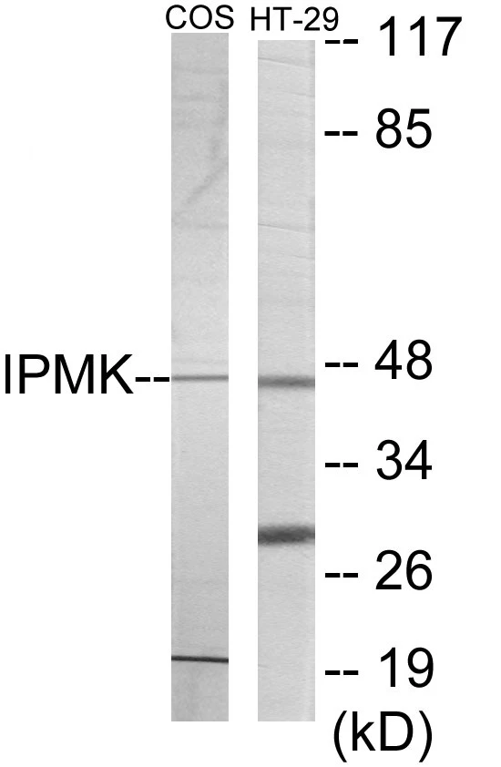 IPMK Cell Based ELISA Kit (A103302-96)