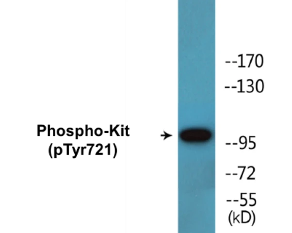 Kit (phospho Tyr721) Cell Based ELISA Kit (A102404-296)