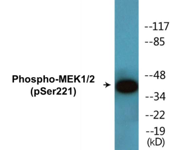 MEK1 + 2 (phospho Ser221) Cell Based ELISA Kit (A102586-296)