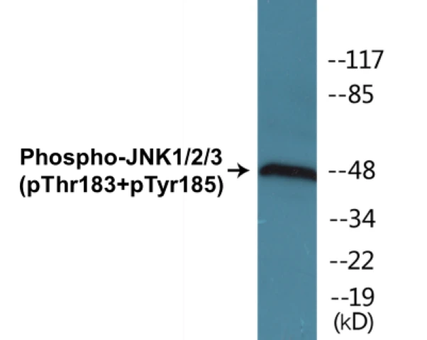 JNK1 + 2 + 3 (phospho Thr183 + Tyr185) Cell Based ELISA Kit (A102233-296)