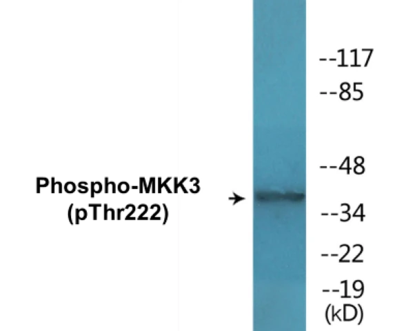 MKK3 (phospho Thr222) Cell Based ELISA Kit (A102349-296)