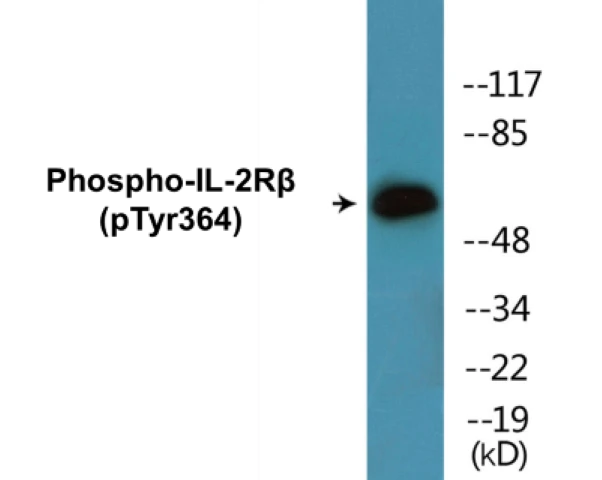 IL-2R beta (phospho Tyr364) Cell Based ELISA Kit (A102520-296)