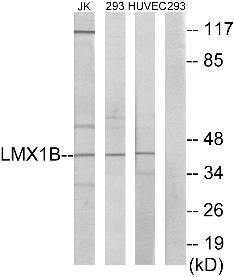 LMX1B Cell Based ELISA Kit (A103463-96)