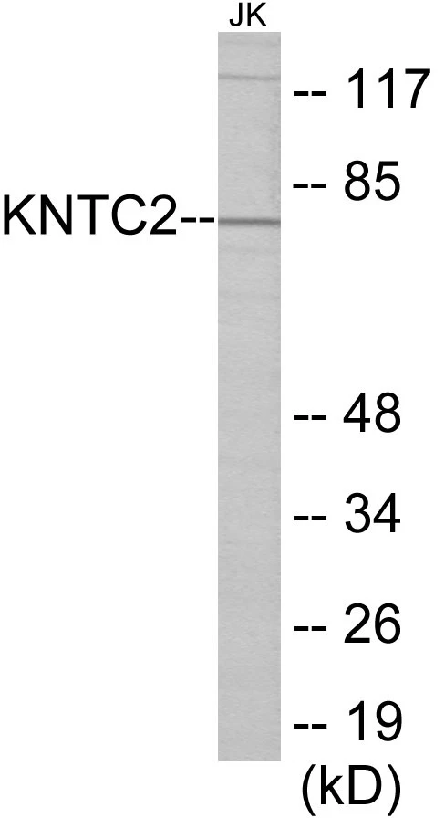 KNTC2 Cell Based ELISA Kit (A103458-96)