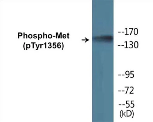 Met (phospho Tyr1356) Cell Based ELISA Kit (A102296-296)