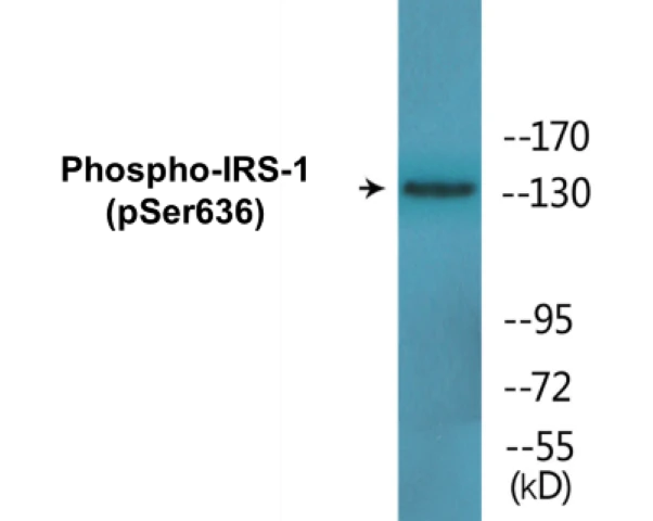 IRS-1 (phospho Ser636) Cell Based ELISA Kit (A102146-296)