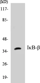 IKB beta Cell Based ELISA Kit (A103390-96)