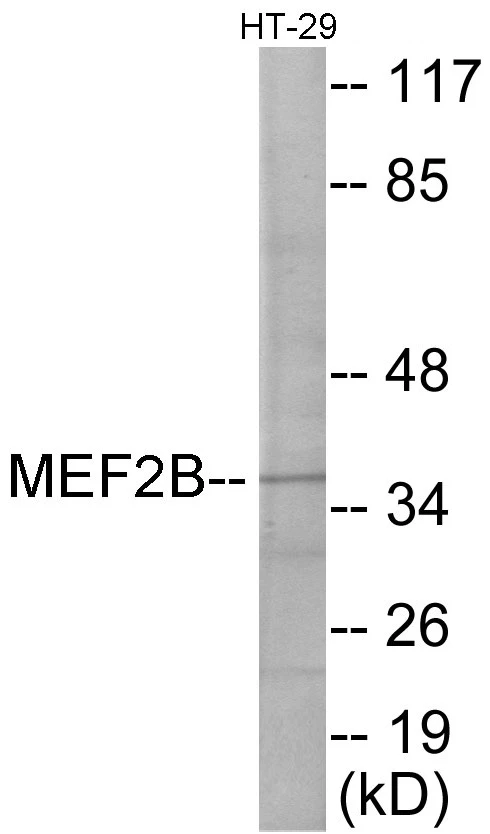 MEF2B Cell Based ELISA Kit (A103474-96)