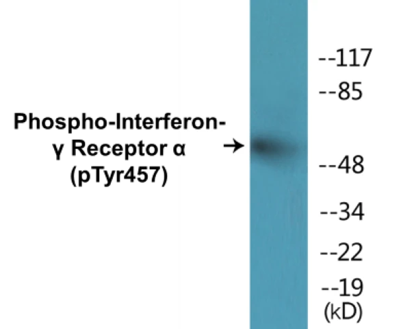 Interferon gamma Receptor alpha (phospho Tyr457) Cell Based ELISA Kit (A102035-296)