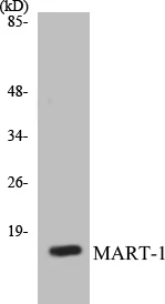 MART-1 Cell Based ELISA Kit (A103649-96)