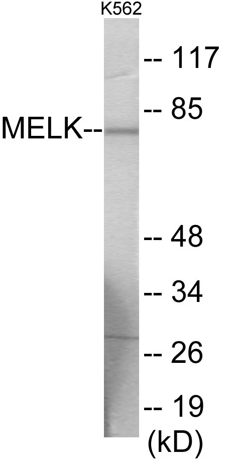 MELK Cell Based ELISA Kit (A103738-96)