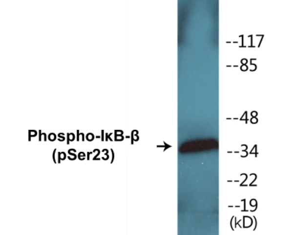 IkB beta (phospho Ser23) Cell Based ELISA Kit (A102053-296)