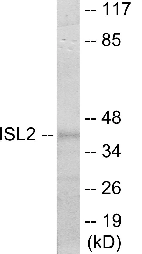 ISL2 Cell Based ELISA Kit (A103304-96)