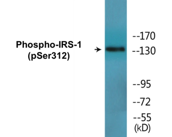 IRS-1 (phospho Ser312) Cell Based ELISA Kit (A102145-296)