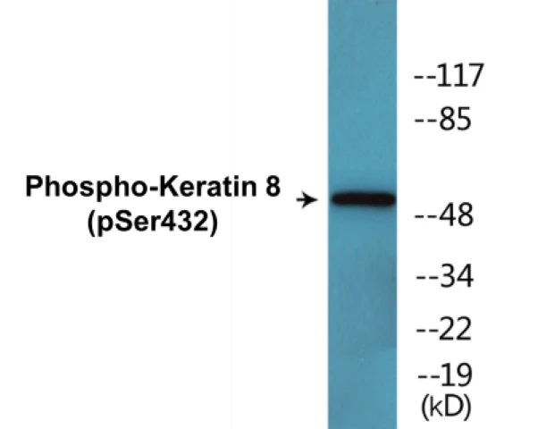 Keratin 8 (phospho Ser432) Cell Based ELISA Kit (A102548-296)