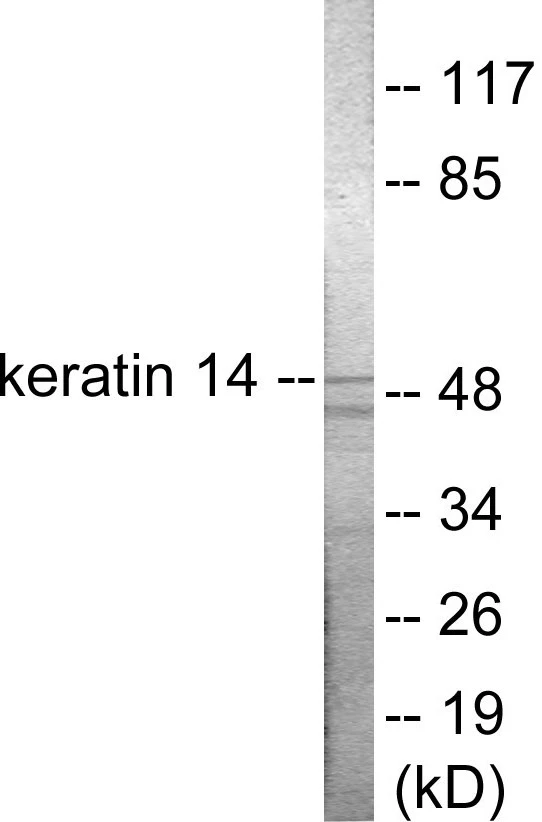 Keratin 14 Cell Based ELISA Kit (A102903-96)