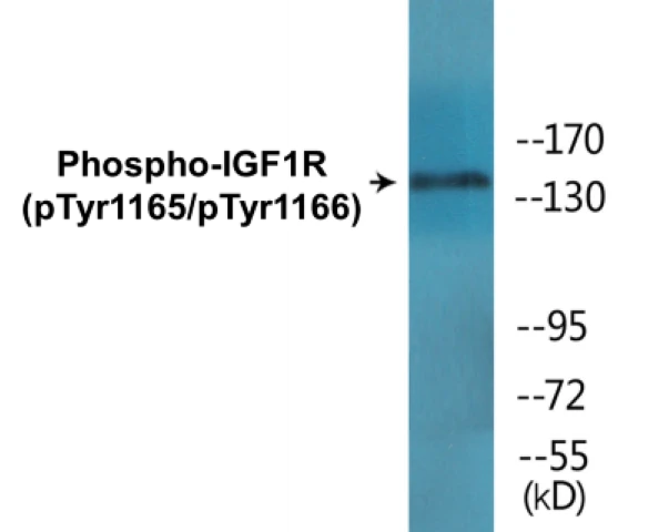 IGF1R (phospho Tyr1165 + Tyr1166) Cell Based ELISA Kit (A102115-296)