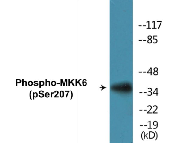 MKK6 (phospho Ser207) Cell Based ELISA Kit (A102282-296)