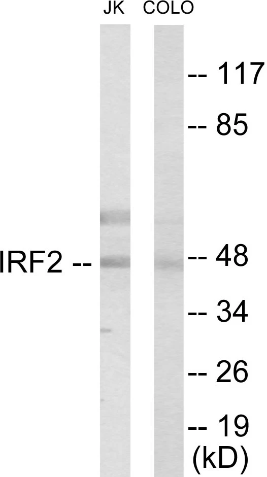 IRF2 Cell Based ELISA Kit (A103274-96)